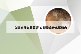 白斑吃什么蔬菜好 白斑能吃什么菜和肉