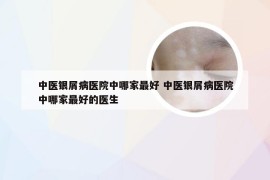 中医银屑病医院中哪家最好 中医银屑病医院中哪家最好的医生