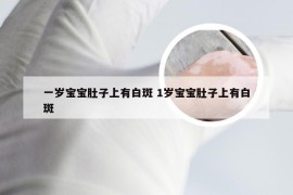 一岁宝宝肚子上有白斑 1岁宝宝肚子上有白斑