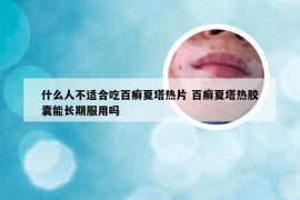 什么人不适合吃百癣夏塔热片 百癣夏塔热胶囊能长期服用吗
