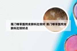 厦门哪家医院皮肤科比较好 厦门哪家医院皮肤科比较好点