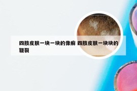 四肢皮肤一块一块的像癣 四肢皮肤一块块的皲裂