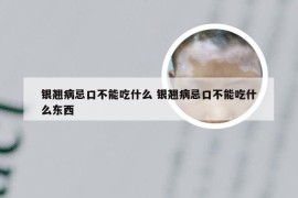 银翘病忌口不能吃什么 银翘病忌口不能吃什么东西