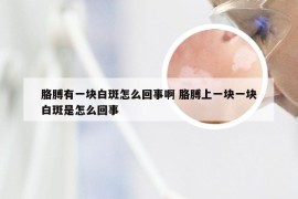 胳膊有一块白斑怎么回事啊 胳膊上一块一块白斑是怎么回事