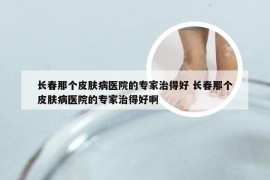 长春那个皮肤病医院的专家治得好 长春那个皮肤病医院的专家治得好啊