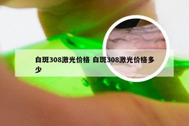 白斑308激光价格 白斑308激光价格多少