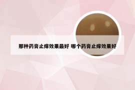 那种药膏止痒效果最好 哪个药膏止痒效果好