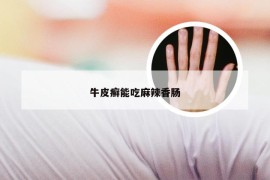 牛皮癣能吃麻辣香肠