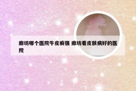 廊坊哪个医院牛皮癣强 廊坊看皮肤病好的医院