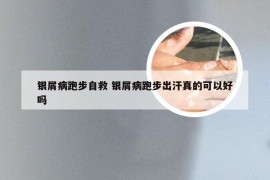 银屑病跑步自救 银屑病跑步出汗真的可以好吗