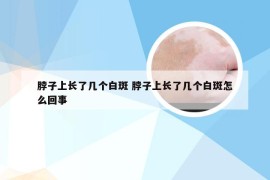 脖子上长了几个白斑 脖子上长了几个白斑怎么回事