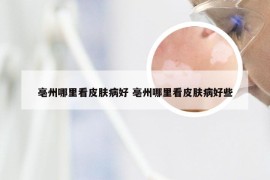 亳州哪里看皮肤病好 亳州哪里看皮肤病好些