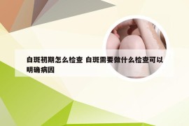 白斑初期怎么检查 白斑需要做什么检查可以明确病因