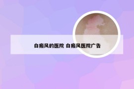 白瘢风的医院 白瘢风医院广告