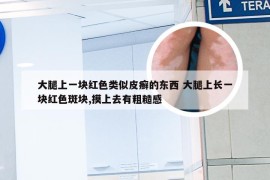 大腿上一块红色类似皮癣的东西 大腿上长一块红色斑块,摸上去有粗糙感