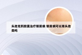 头孢克肟胶囊治疗银屑病 银屑病可以用头孢类吗