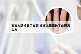 宝宝大腿根长了白斑 宝宝大腿根长了白斑怎么办