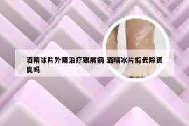 酒精冰片外用治疗银屑病 酒精冰片能去除狐臭吗