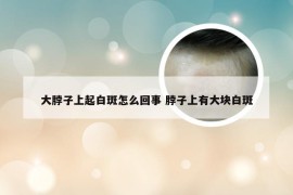 大脖子上起白斑怎么回事 脖子上有大块白斑
