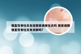 强直性脊柱炎包括银屑病脊柱炎吗 银屑病跟强直性脊柱炎有关联吗?