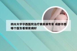四川大学华西医院治疗银屑病专家 成都华西哪个医生看银屑病好