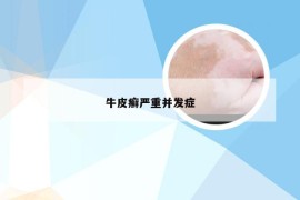 牛皮癣严重并发症