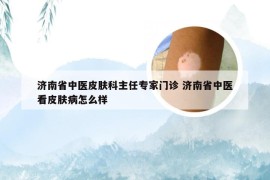 济南省中医皮肤科主任专家门诊 济南省中医看皮肤病怎么样