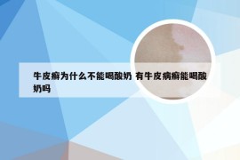 牛皮癣为什么不能喝酸奶 有牛皮病癣能喝酸奶吗
