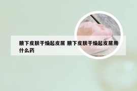腋下皮肤干燥起皮屑 腋下皮肤干燥起皮屑用什么药