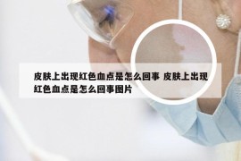 皮肤上出现红色血点是怎么回事 皮肤上出现红色血点是怎么回事图片