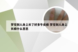 梦见别人身上长了好多牛皮癣 梦见别人身上长癣什么意思