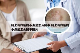 腿上有白色的小点是怎么回事 腿上有白色的小点是怎么回事图片