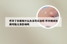 怀孕了长癣有什么办法可以治吗 怀孕期间长癣对胎儿有影响吗