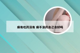 癣有吃药没有 癣不涂药自己会好吗