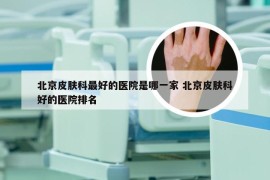 北京皮肤科最好的医院是哪一家 北京皮肤科好的医院排名