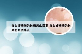 身上好端端的长癣怎么回事 身上好端端的长癣怎么回事儿