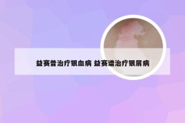 益赛普治疗银血病 益赛谱治疗银屑病