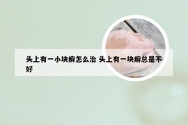 头上有一小块癣怎么治 头上有一块癣总是不好