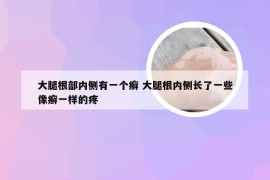 大腿根部内侧有一个癣 大腿根内侧长了一些像癣一样的疼
