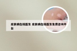 皮肤病在线医生 皮肤病在线医生免费咨询平台