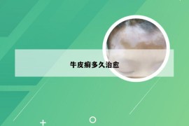 牛皮癣多久治愈