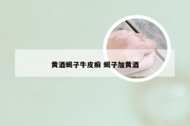 黄酒蝎子牛皮癣 蝎子加黄酒