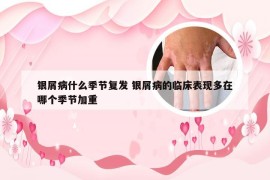 银屑病什么季节复发 银屑病的临床表现多在哪个季节加重
