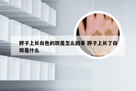 脖子上长白色的斑是怎么回事 脖子上长了白斑是什么