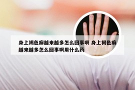 身上褐色癣越来越多怎么回事啊 身上褐色癣越来越多怎么回事啊用什么药