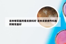 吉林哪家医院看皮肤科好 吉林皮肤病专科医院哪家最好