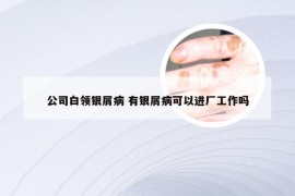 公司白领银屑病 有银屑病可以进厂工作吗