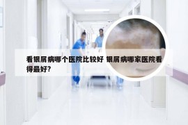 看银屑病哪个医院比较好 银屑病哪家医院看得最好?