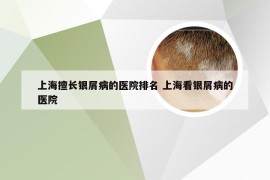 上海擅长银屑病的医院排名 上海看银屑病的医院