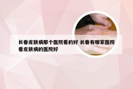 长春皮肤病那个医院看的好 长春有哪家医院看皮肤病的医院好